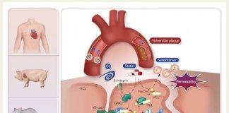 Tajvanski raziskovalci odkrili nov biomarker za aterosklerozo Foto: Nacionalni svet za znanost in tehnologijo.