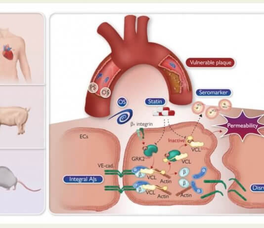 Tajvanski raziskovalci odkrili nov biomarker za aterosklerozo Foto: Nacionalni svet za znanost in tehnologijo.